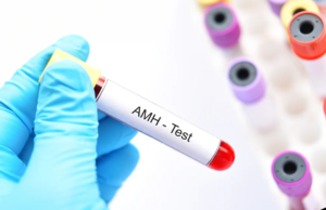 AMH Blood Test