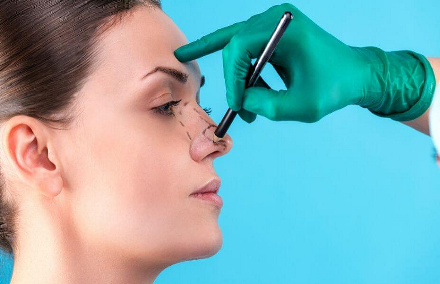What Are the Benefits of Rhinoplasty